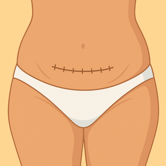 C-Section Recovery Guide