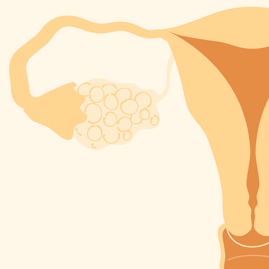 PCOS Has a New Name (And No, You Didn't Miss Anything)